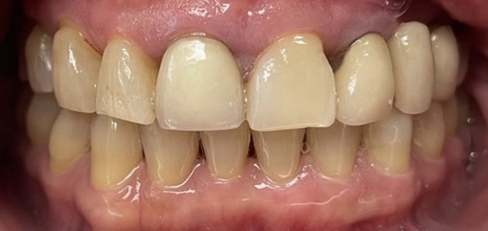 Before treatment clinical photo.