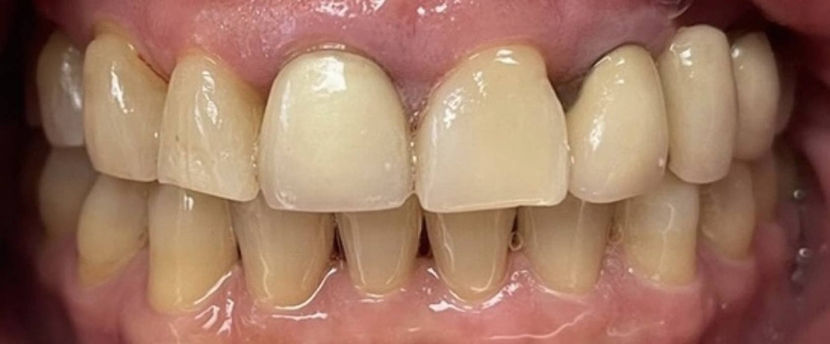 Before treatment clinical photo.