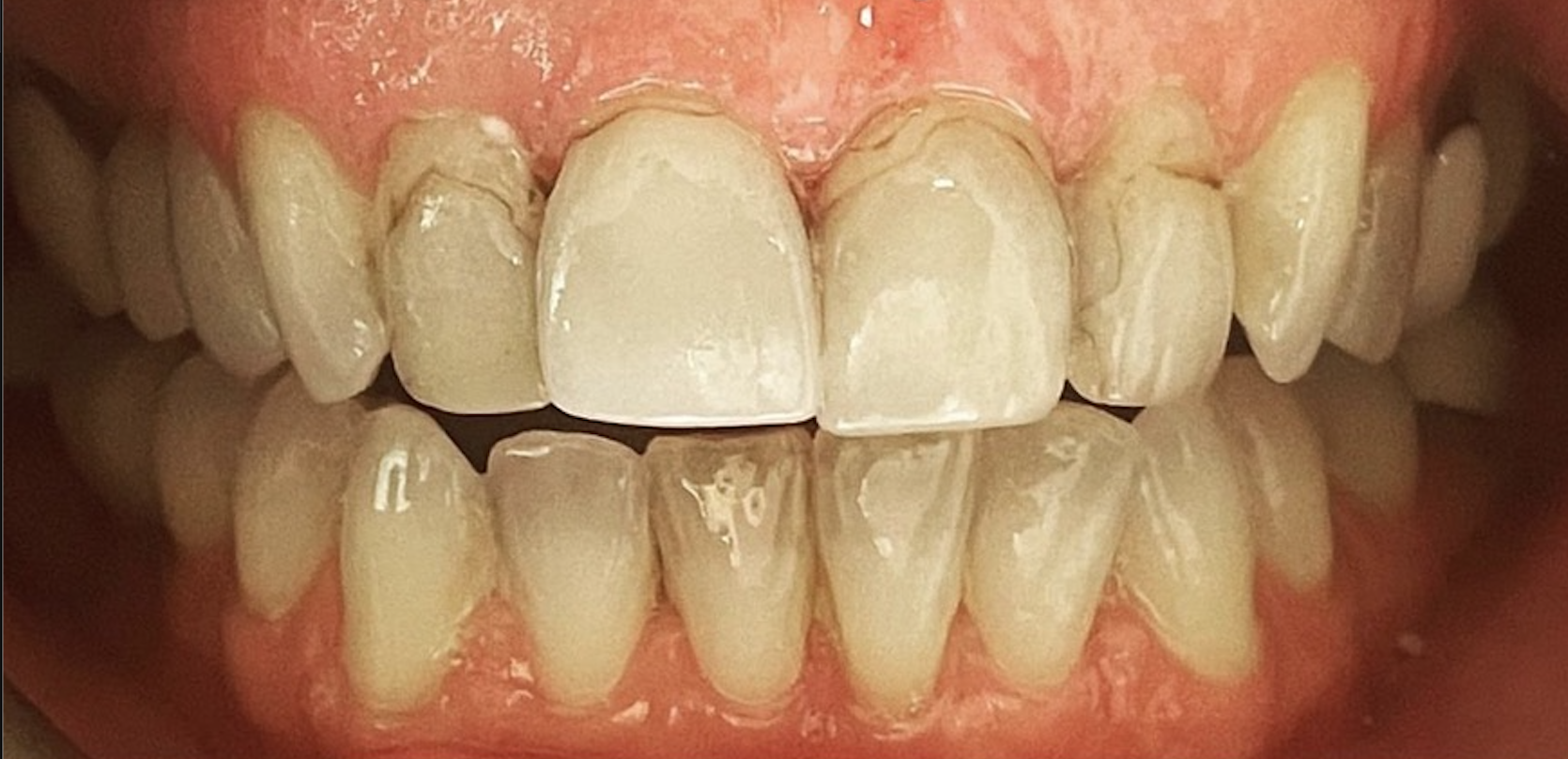 Before treatment clinical photo.