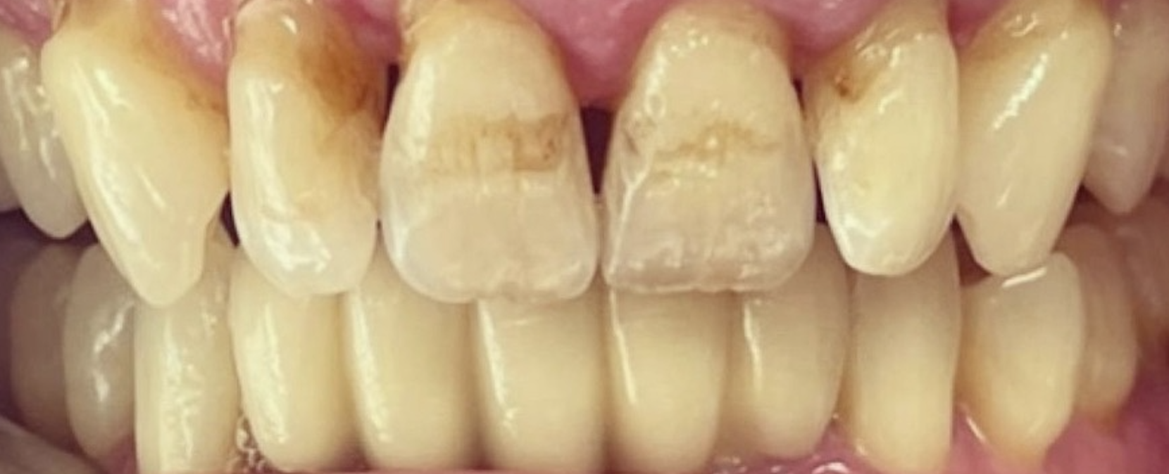 Before treatment clinical photo.