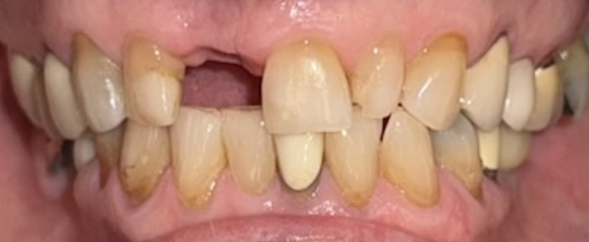 Before treatment clinical photo.