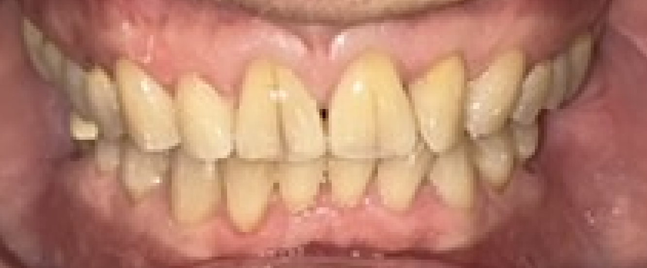 Before treatment clinical photo.