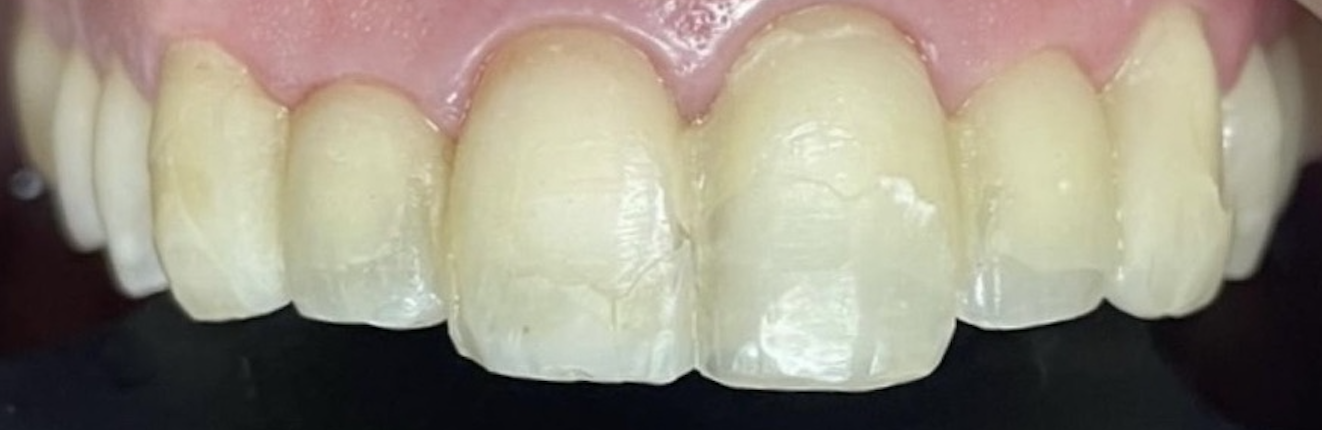 Before treatment clinical photo.