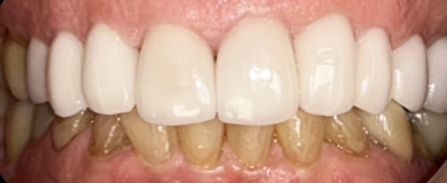 After treatment clinical photo.