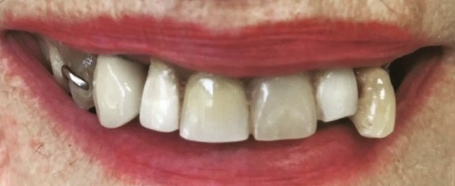 Before treatment clinical photo.