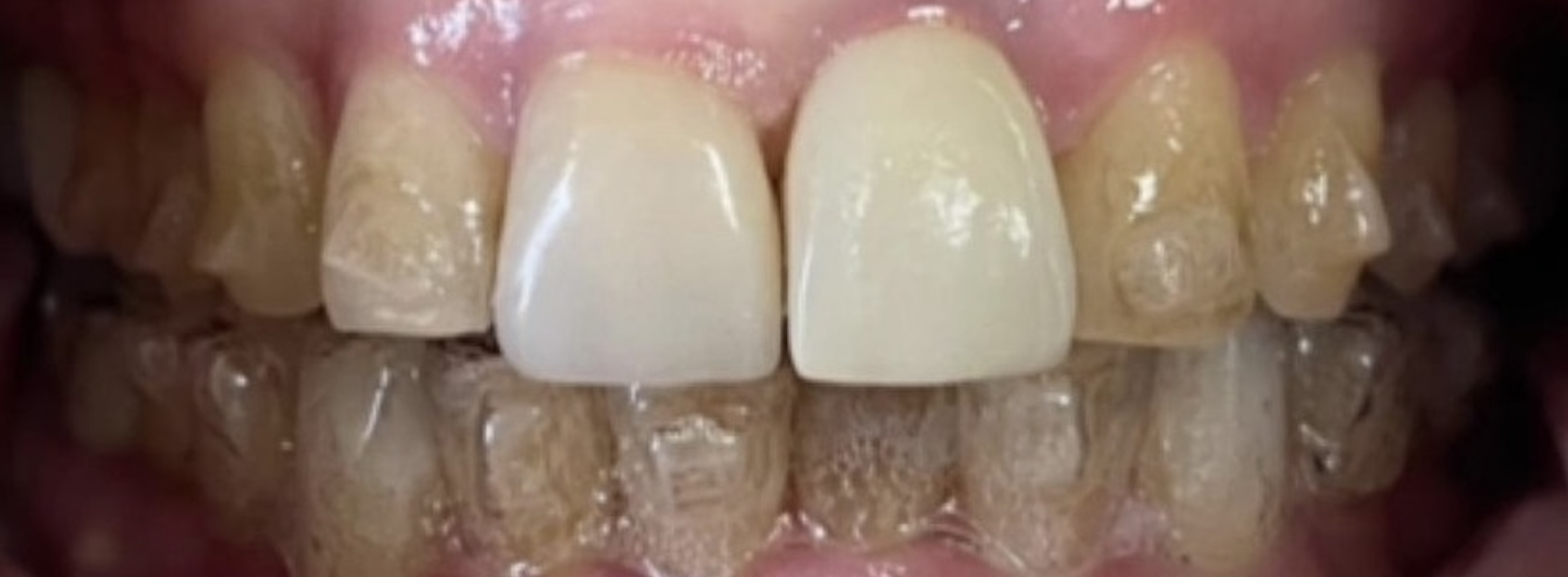 Before treatment clinical photo.