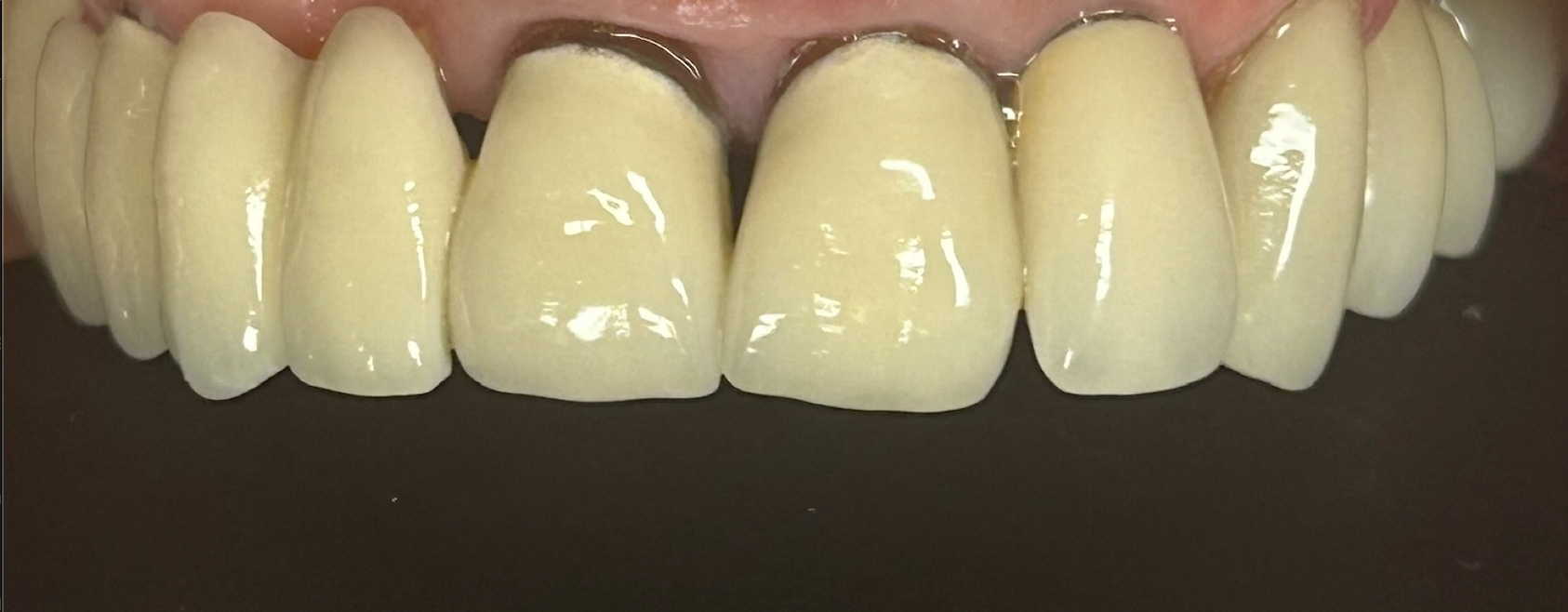 Before treatment clinical photo.