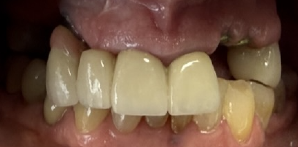 Before treatment clinical photo.