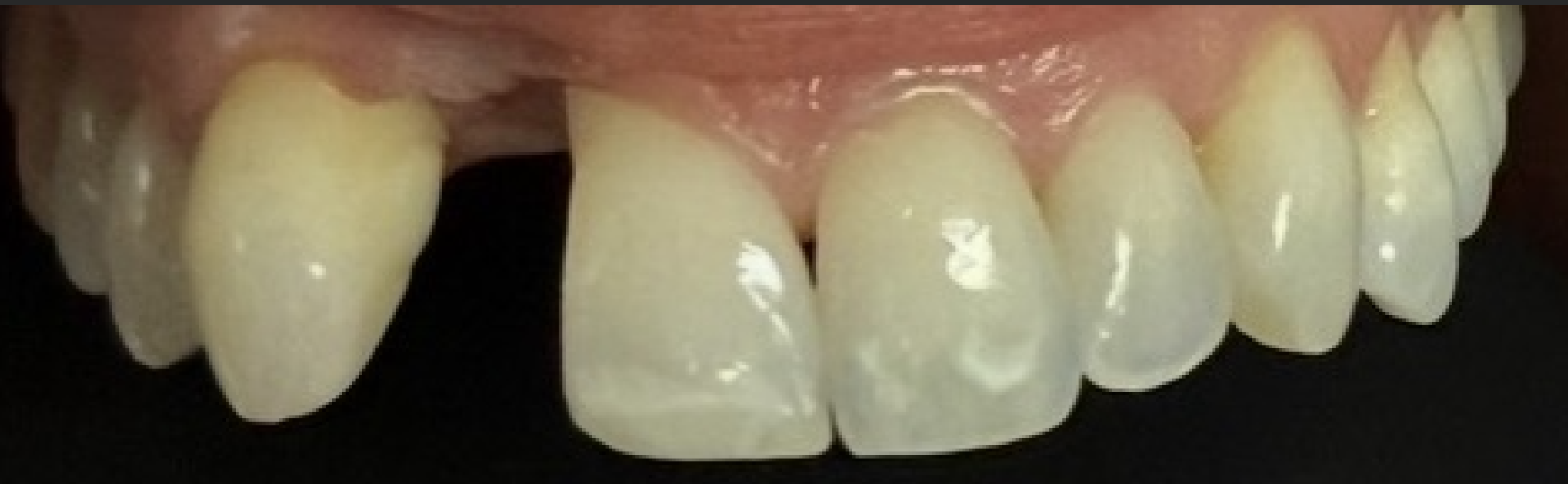 Before treatment clinical photo.