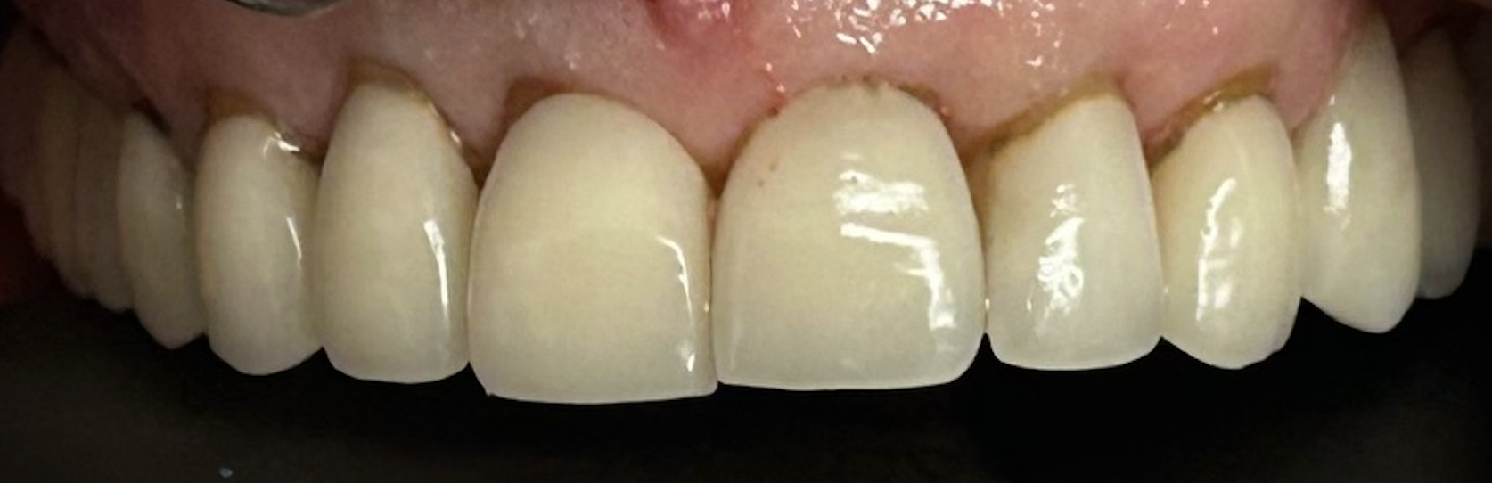 Before treatment clinical photo.