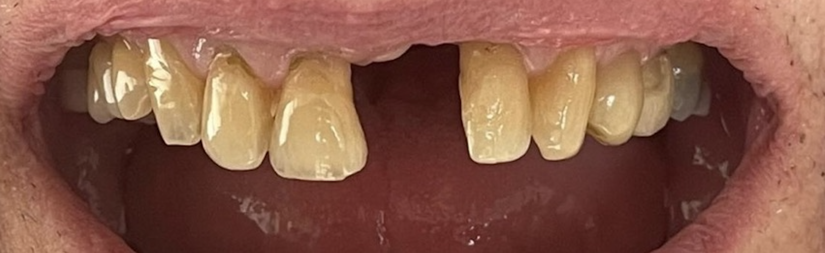 Before treatment clinical photo.