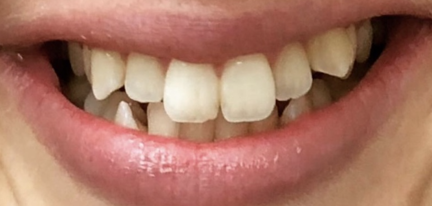 Before treatment clinical photo.