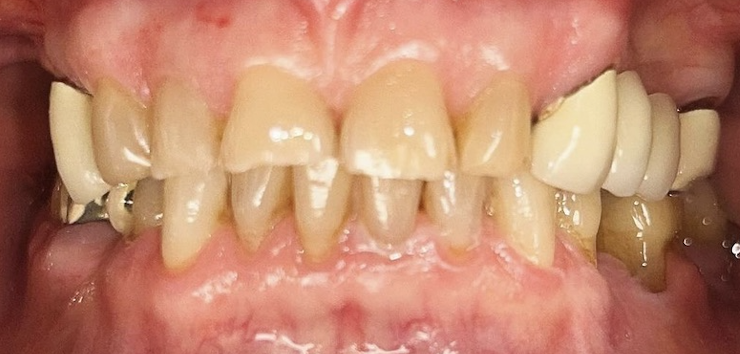 Before treatment clinical photo.